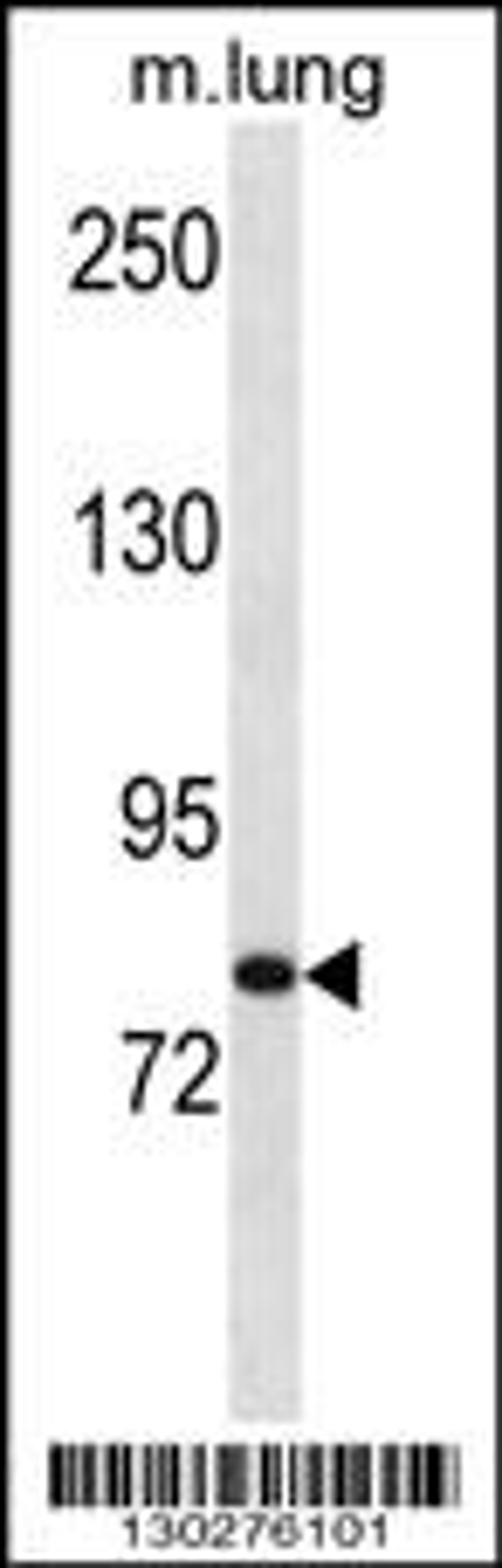 Western blot analysis in mouse lung tissue lysates (35ug/lane).