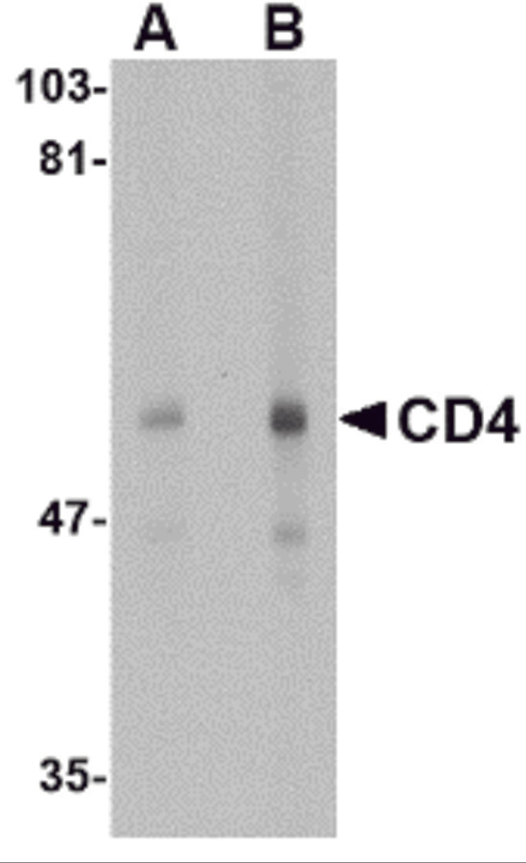Western blot analysis of CD4 in human thymus tissue lysate with CD4 antibody at (A) 0.5 and (B) 1 μg/mL.