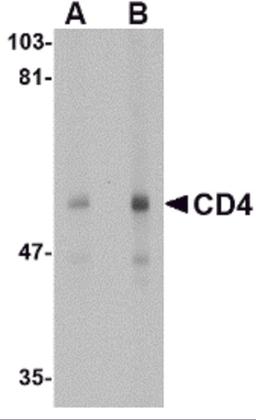 Western blot analysis of CD4 in human thymus tissue lysate with CD4 antibody at (A) 0.5 and (B) 1 μg/mL.