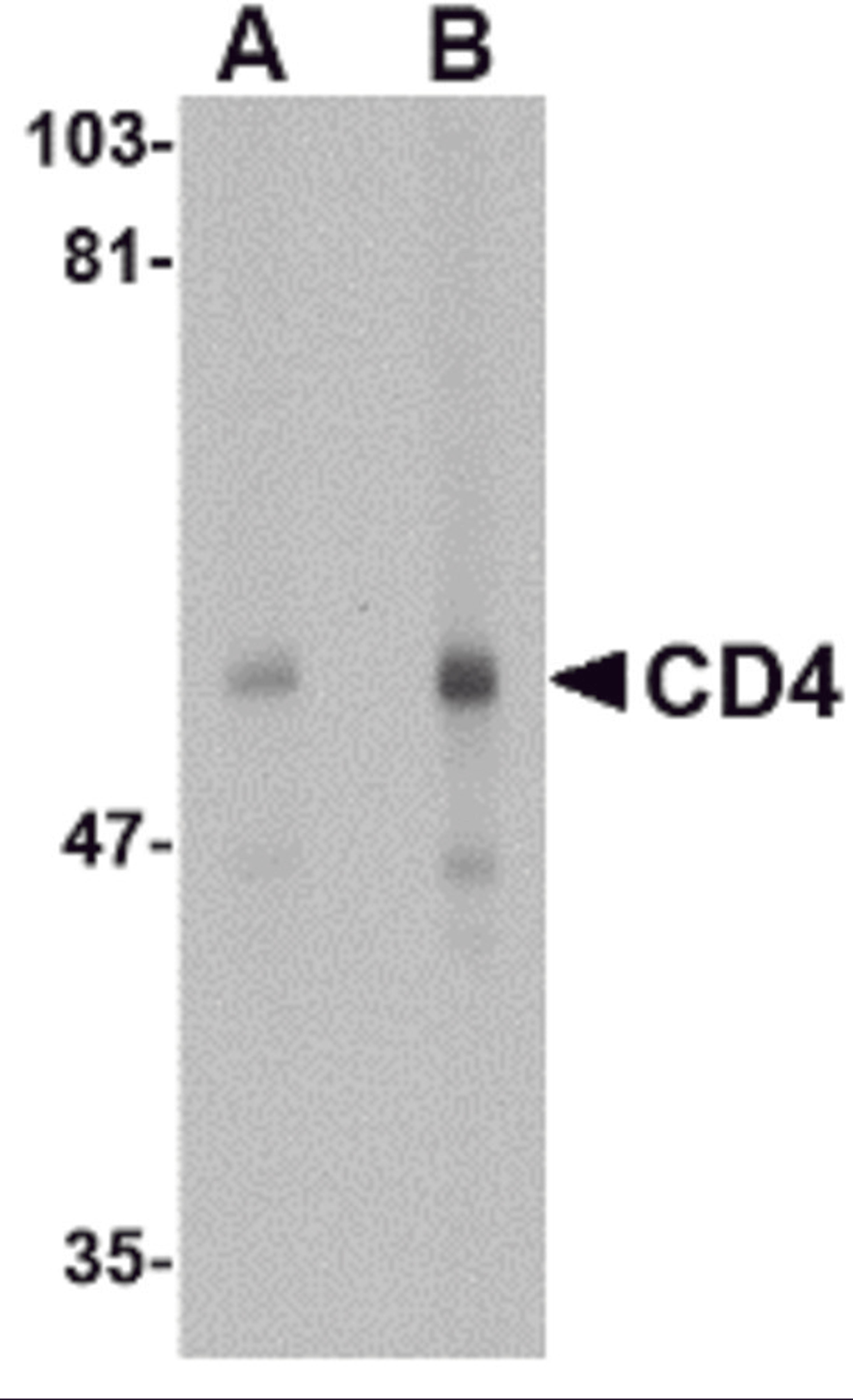 Western blot analysis of CD4 in human thymus tissue lysate with CD4 antibody at (A) 0.5 and (B) 1 μg/mL.