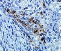 Immunohistochemistry-Paraffin: DC-LAMP Antibody (1010E1.01) [DDX0191P-100] - Analysis using the Biotin conjugate of DDX0191P-100. Staining of human lymph node.