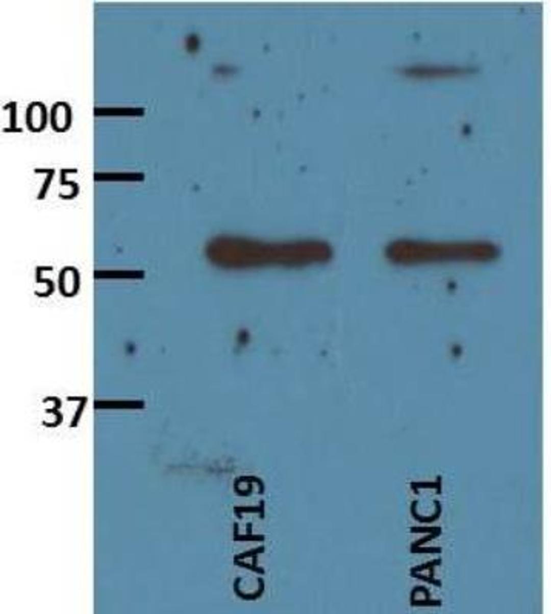 Western Blot: Activin A Antibody (MM0074-7L18) [NBP2-12009] - analysis of Activin A in human pancreatic cancer cells using anti-Activin A antibody. Image from verified customer review.