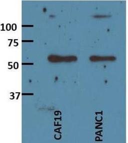 Western Blot: Activin A Antibody (MM0074-7L18) [NBP2-12009] - analysis of Activin A in human pancreatic cancer cells using anti-Activin A antibody. Image from verified customer review.