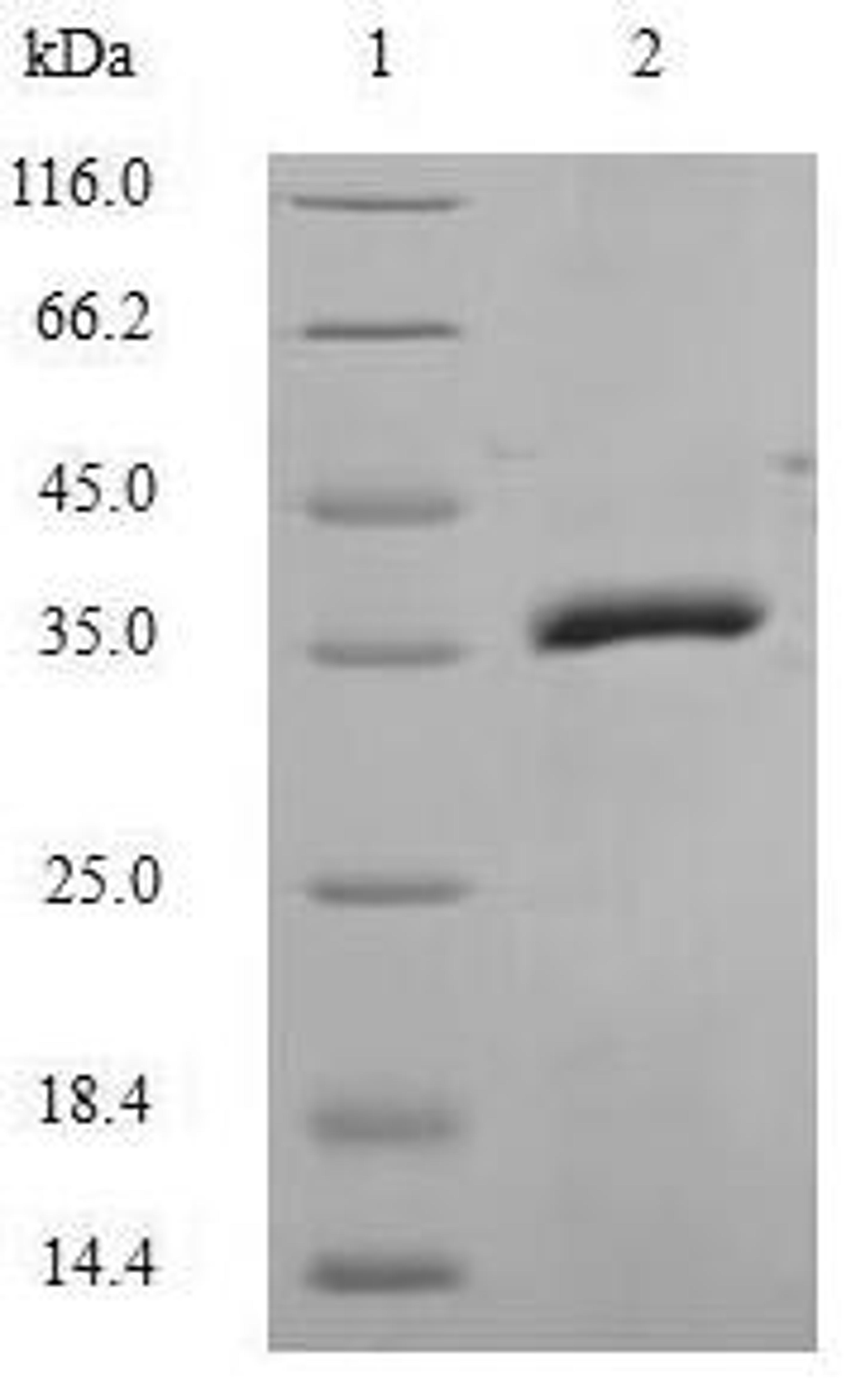 (Tris-Glycine gel) Discontinuous SDS-PAGE (reduced) with 5% enrichment gel and 15% separation gel.