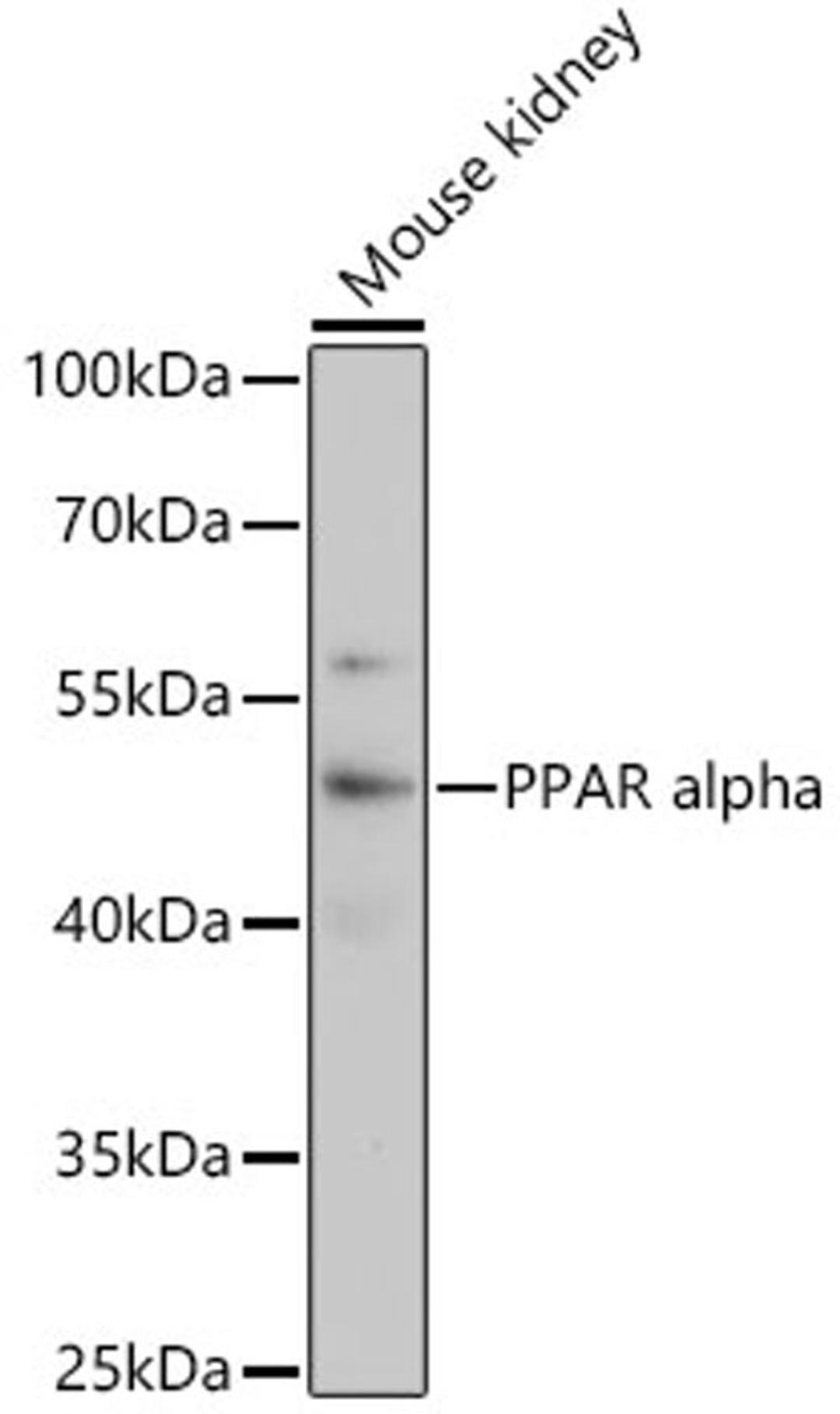 Western blot - PPAR alpha antibody (A3123)