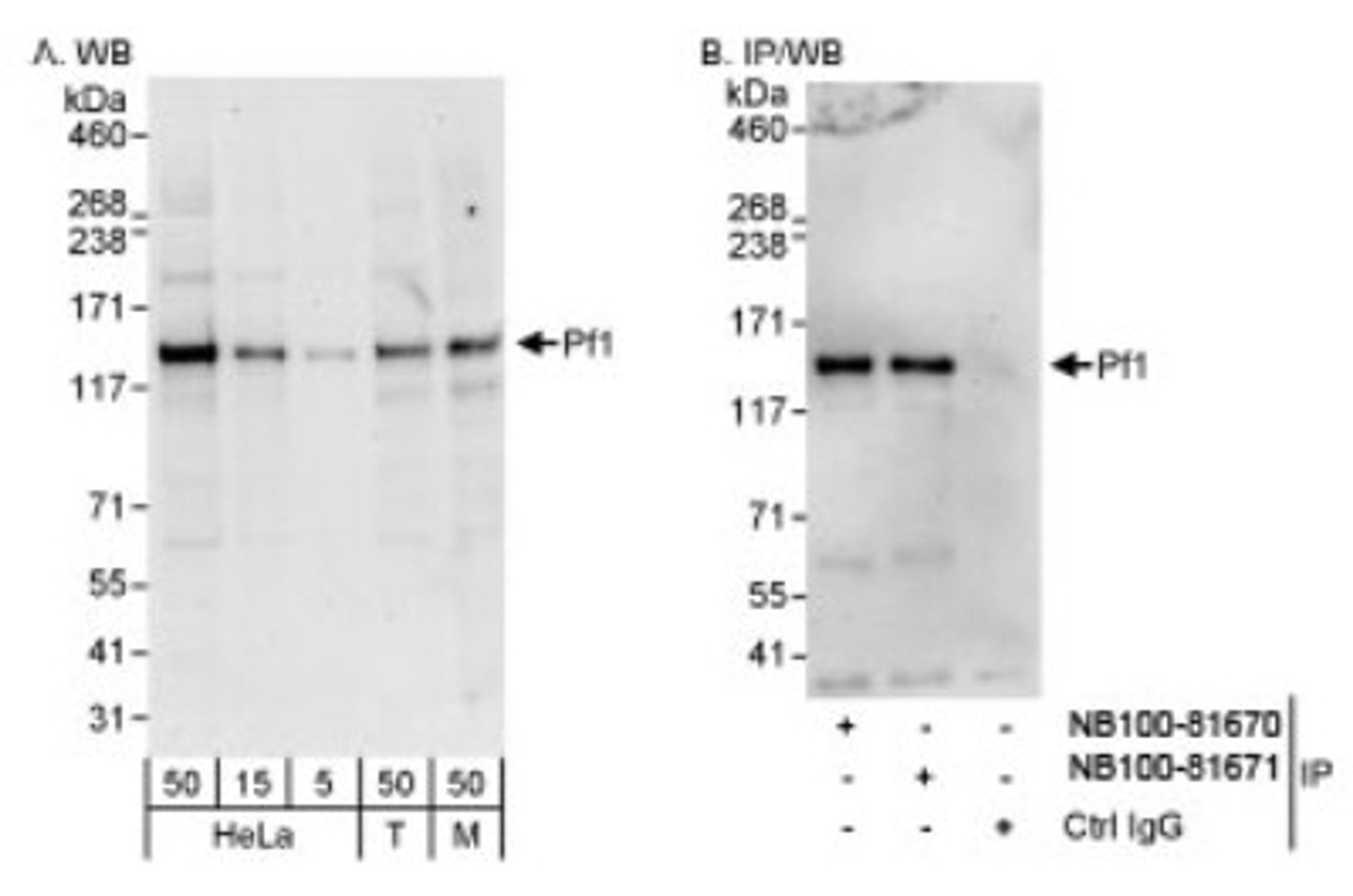 Western Blot: PF1 Antibody [NB100-81671] - Detection of Human and Mouse PF1 on HeLa whole cell lysate using NB100-81671. Pf1 was also  immunoprecipitated by rabbit anti-PF1 antibody NB100-81670.