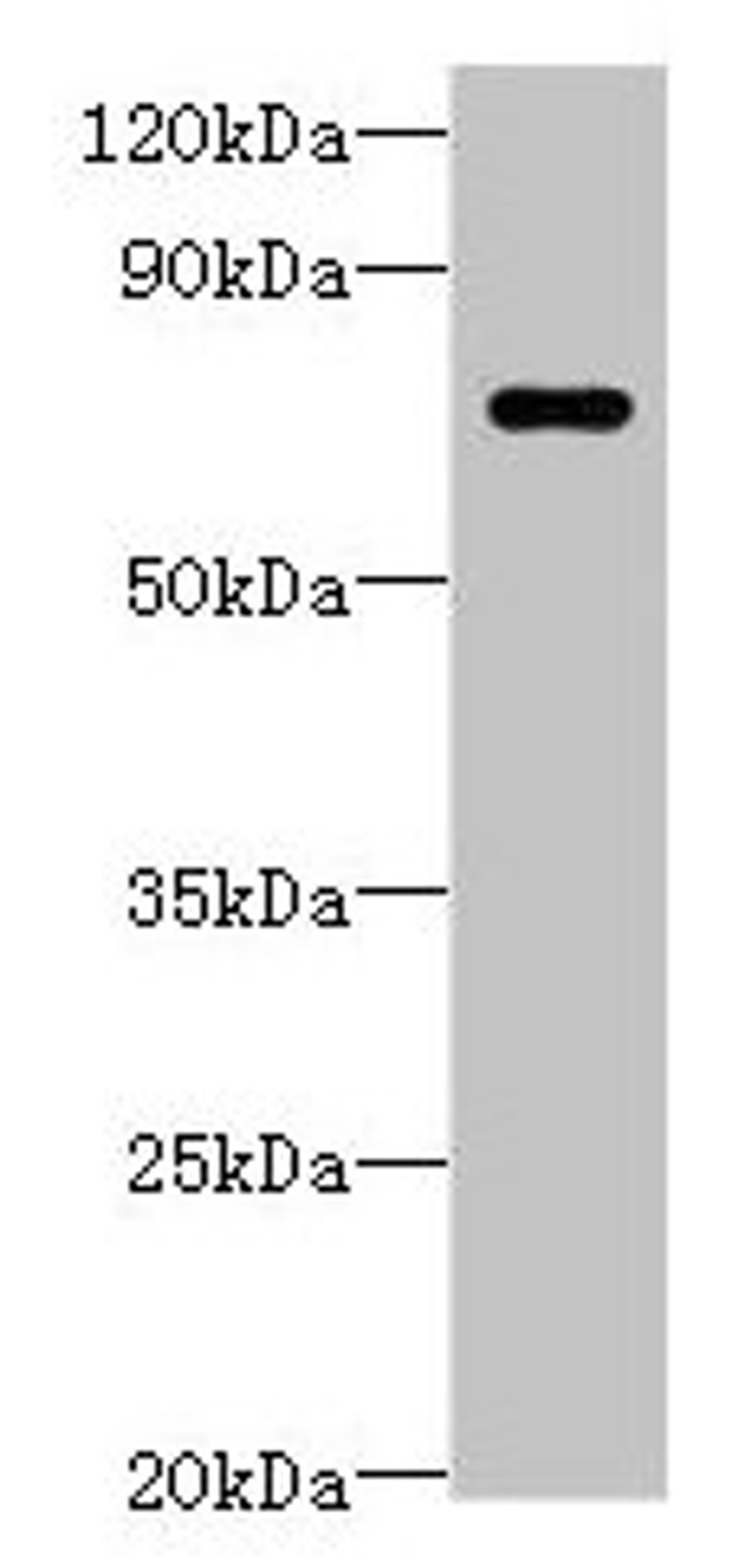 Western blot. All lanes: LRRC40 antibody at 2ug/ml + 293T whole cell lysate. Secondary. Goat polyclonal to rabbit IgG at 1/10000 dilution. Predicted band size: 69 kDa. Observed band size: 69 kDa. 