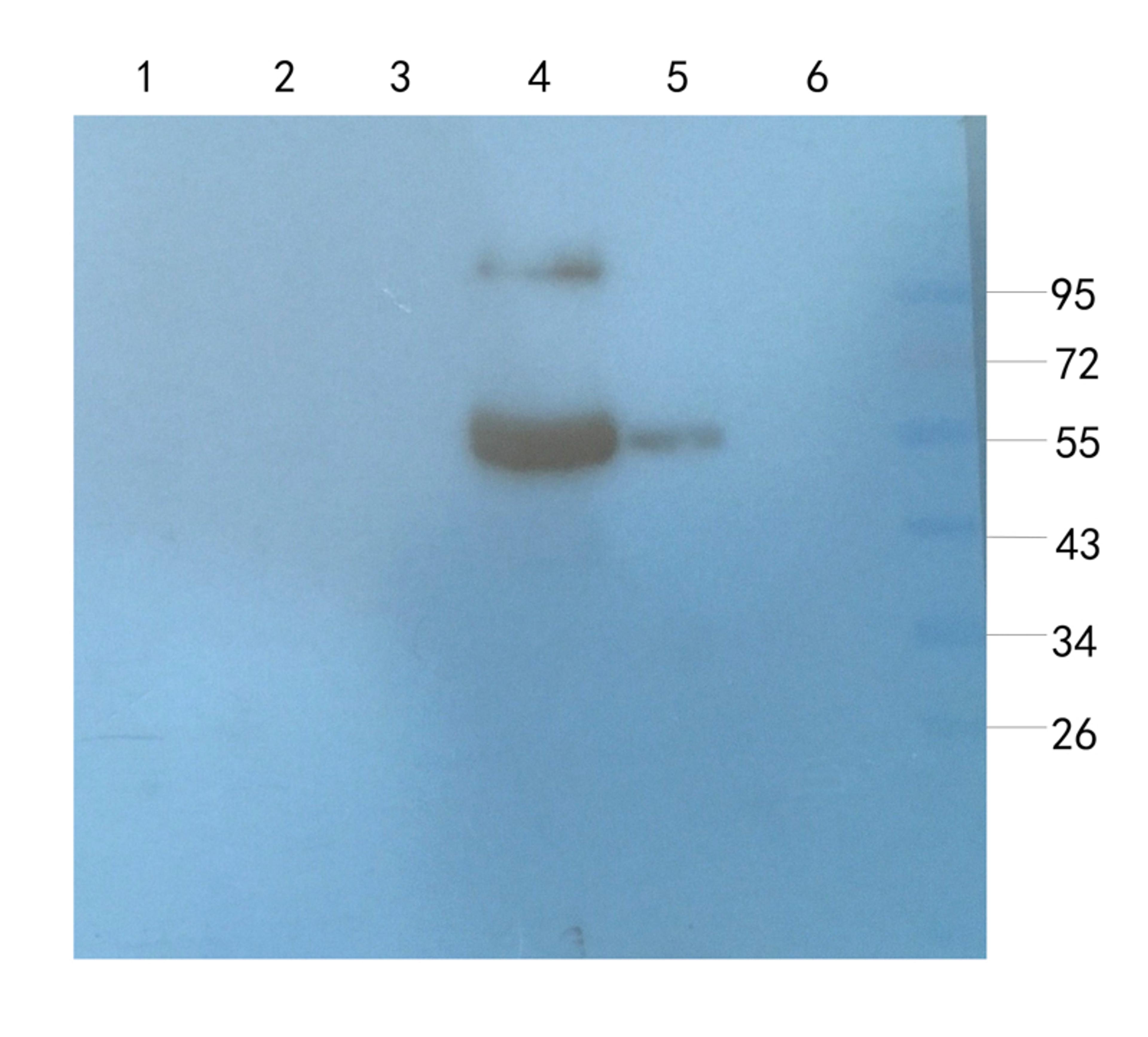 Western blot analysis of mouse brain (lane 1), mouse medulla (lane 2), rat muscle (lane 3), human breast cancer (lane 4), human thyroid tumour (lane 5), U251 cells (lane 6) using Aquaporin 4 antibody (1 ug/ml)