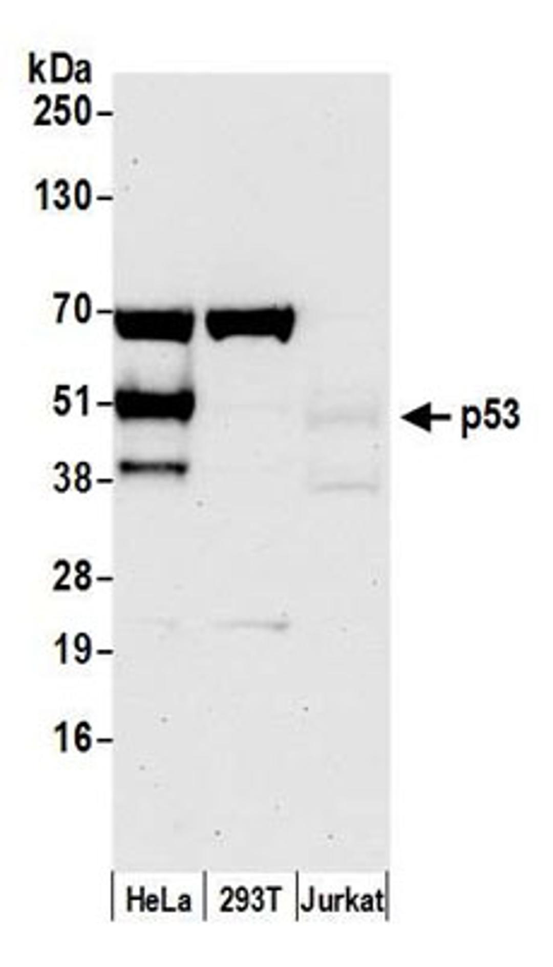 Detection of human p53 by western blot.