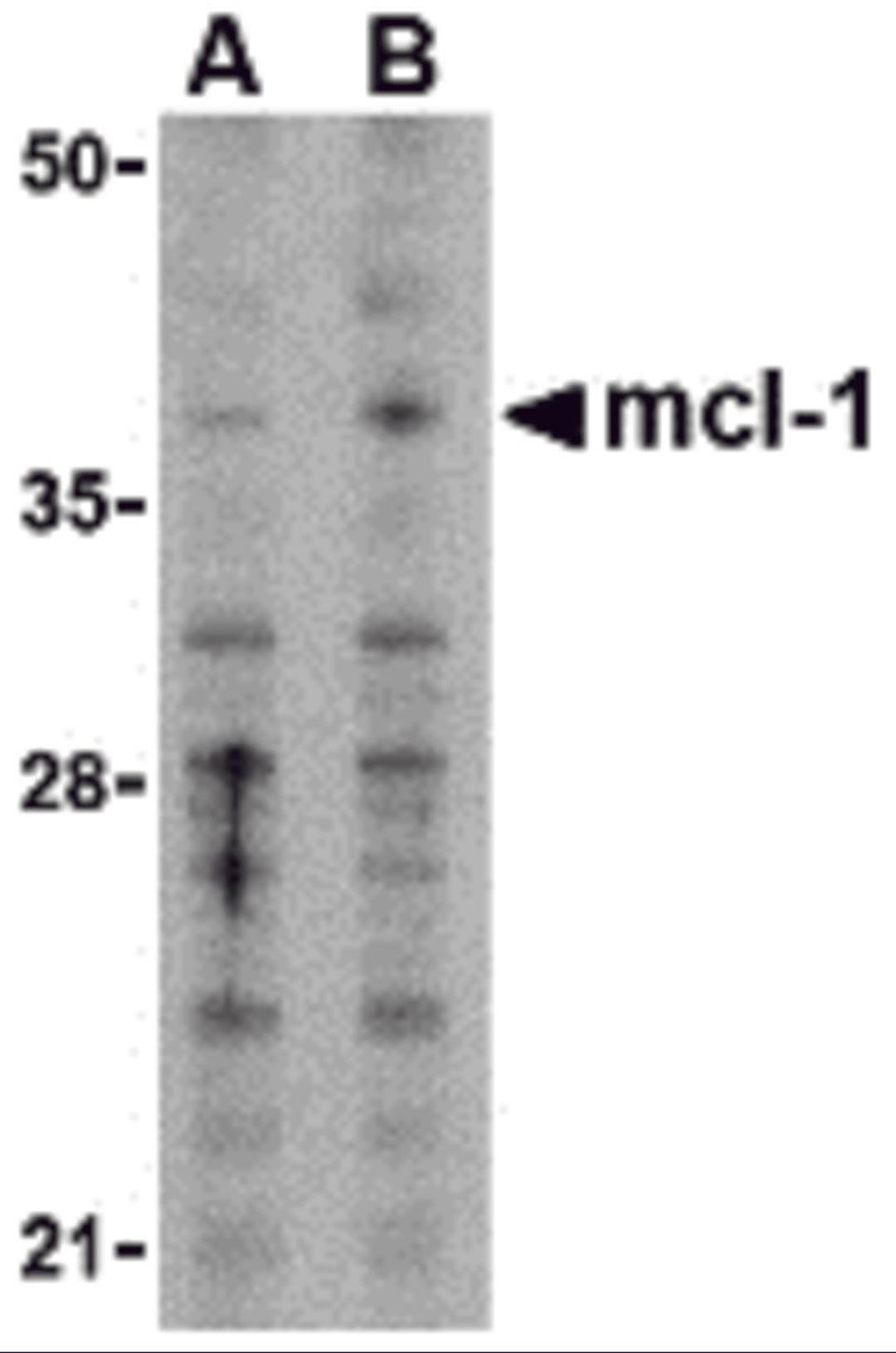 Western blot analysis of Mcl-1in Raji cell lysates with Mcl-1 antibody at (A) 1 and (B) 2 &#956;g/mL. 