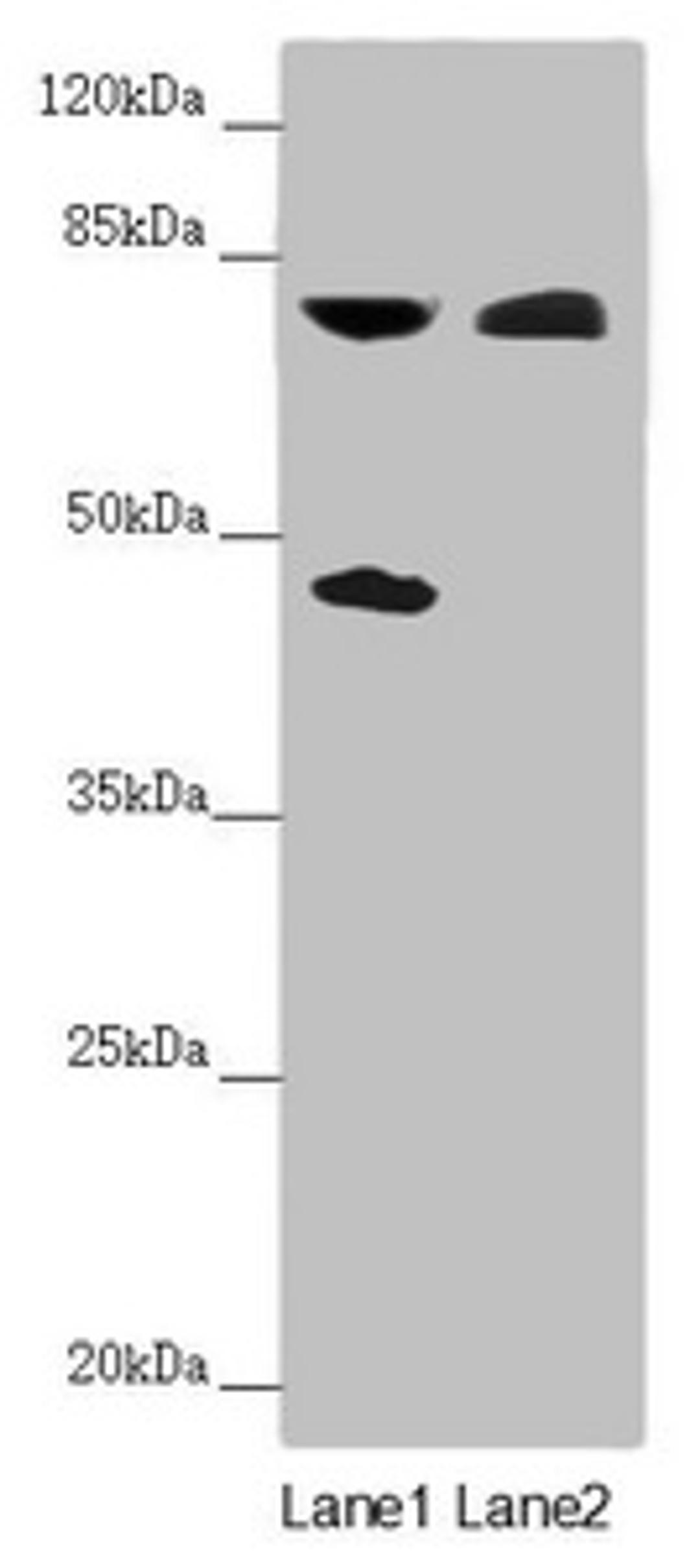 Western blot. All lanes: CEP83 antibody at 2.27 ug/ml. Lane 1: Mouse liver tissue. Lane 2: COLO205 whole cell lysate. Secondary. Goat polyclonal to rabbit IgG at 1/10000 dilution. Predicted band size: 83, 68 kDa. Observed band size: 83, 45 kDa.