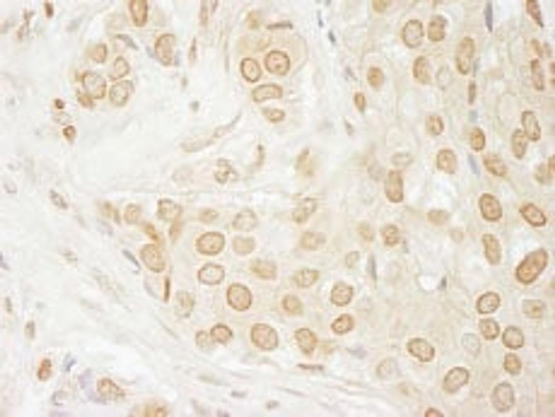 Detection of human USP33 by immunohistochemistry.