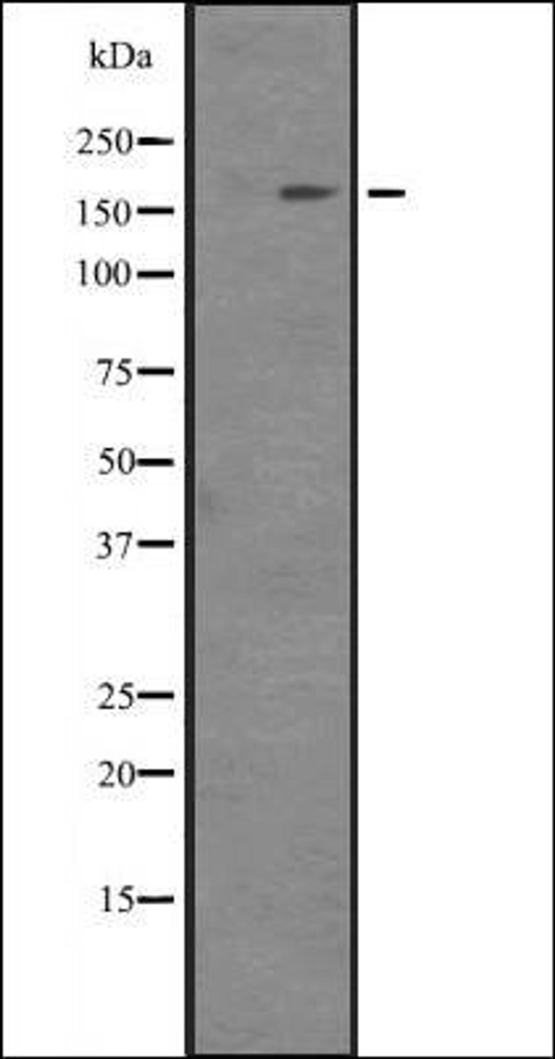 Western blot analysis of TF1 lysate using ITGAM antibody