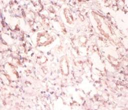 Immunohistochemistry of paraffin-embedded human kidney tissue using CSB-PA00974A0Rb at dilution of 1:100