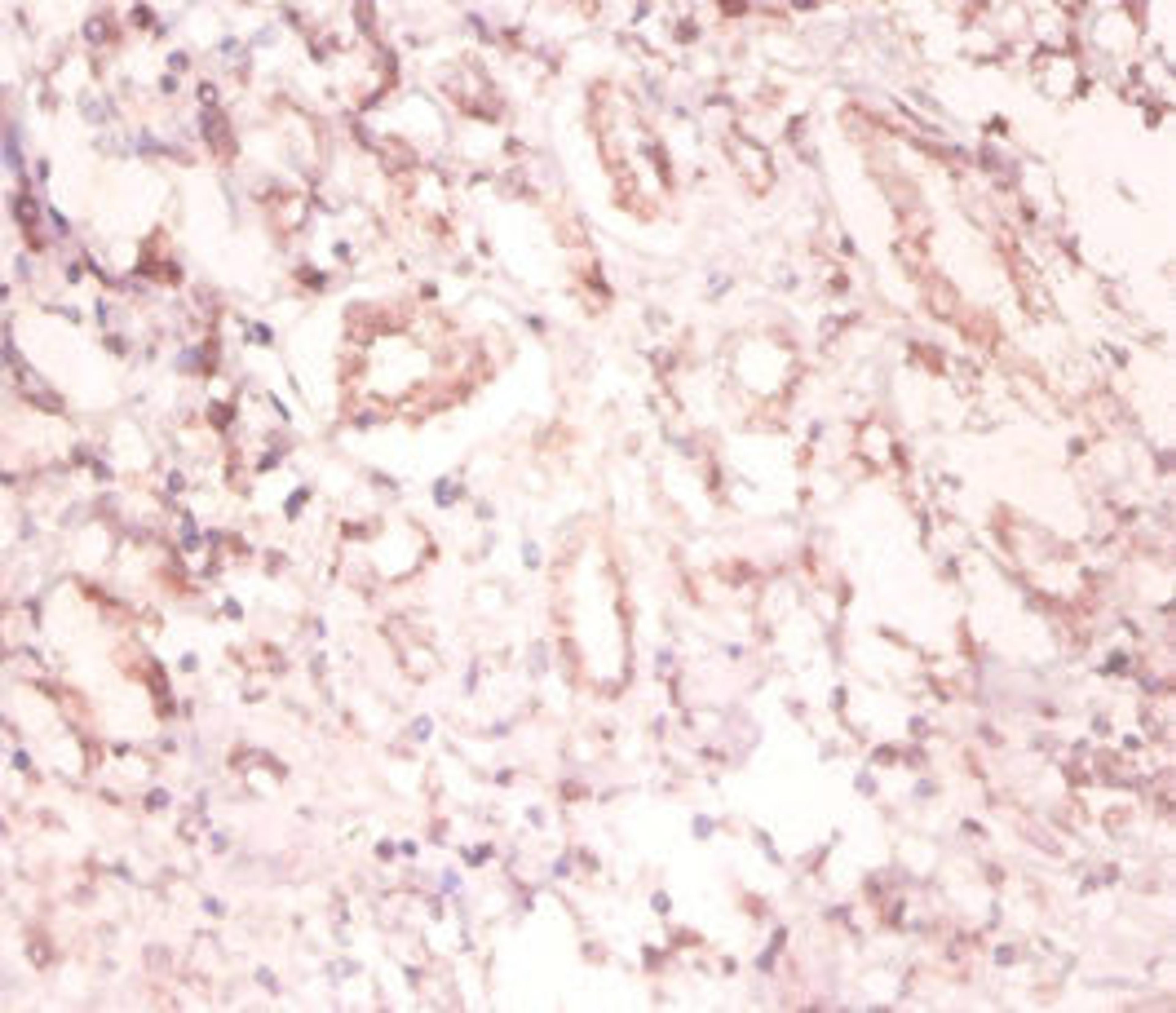 Immunohistochemistry of paraffin-embedded human kidney tissue using CSB-PA00974A0Rb at dilution of 1:100