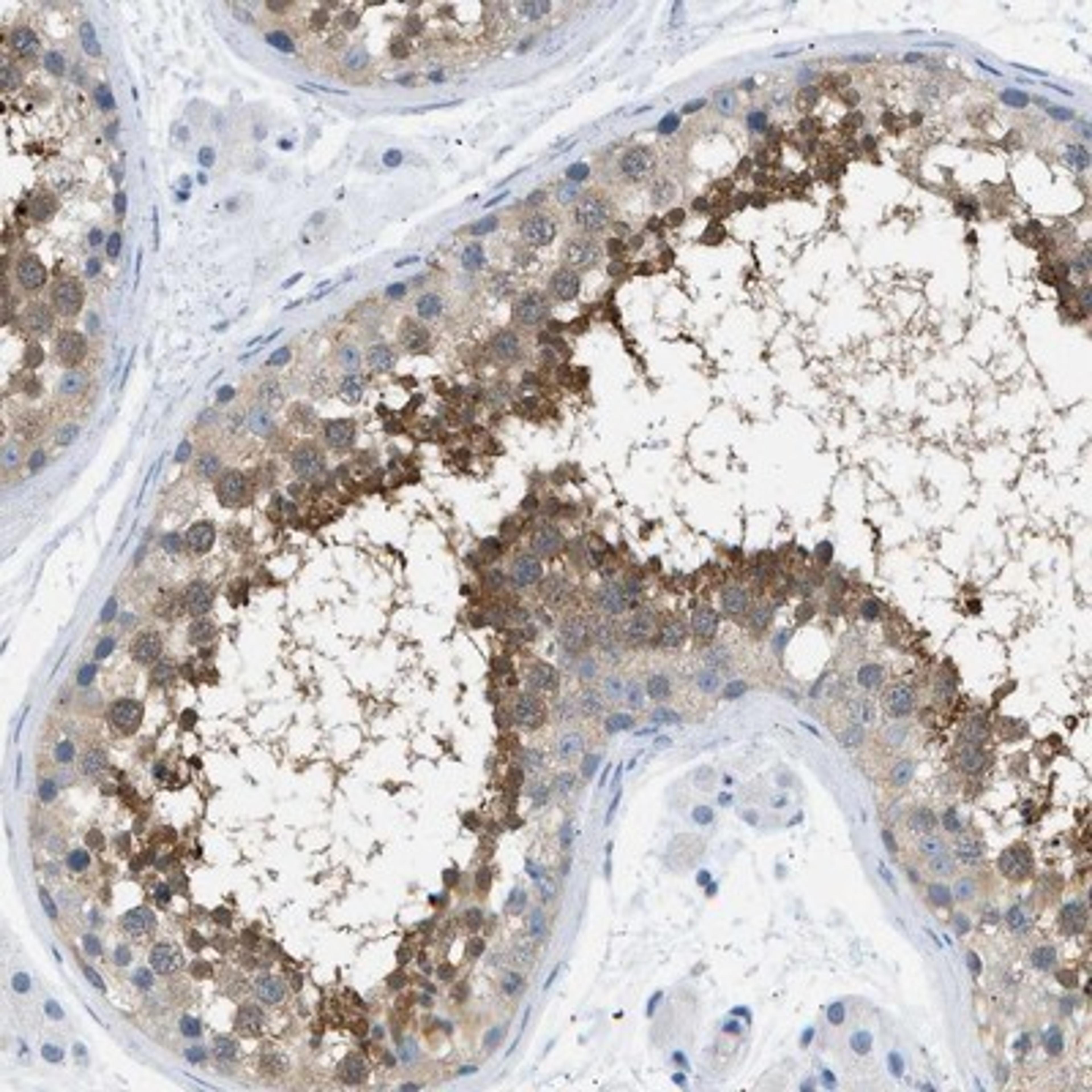 Immunohistochemistry-Paraffin: SPAM1 Antibody [NBP1-81637] - Immunohistochemical staining of human testis shows distinct positivity in spermatids.