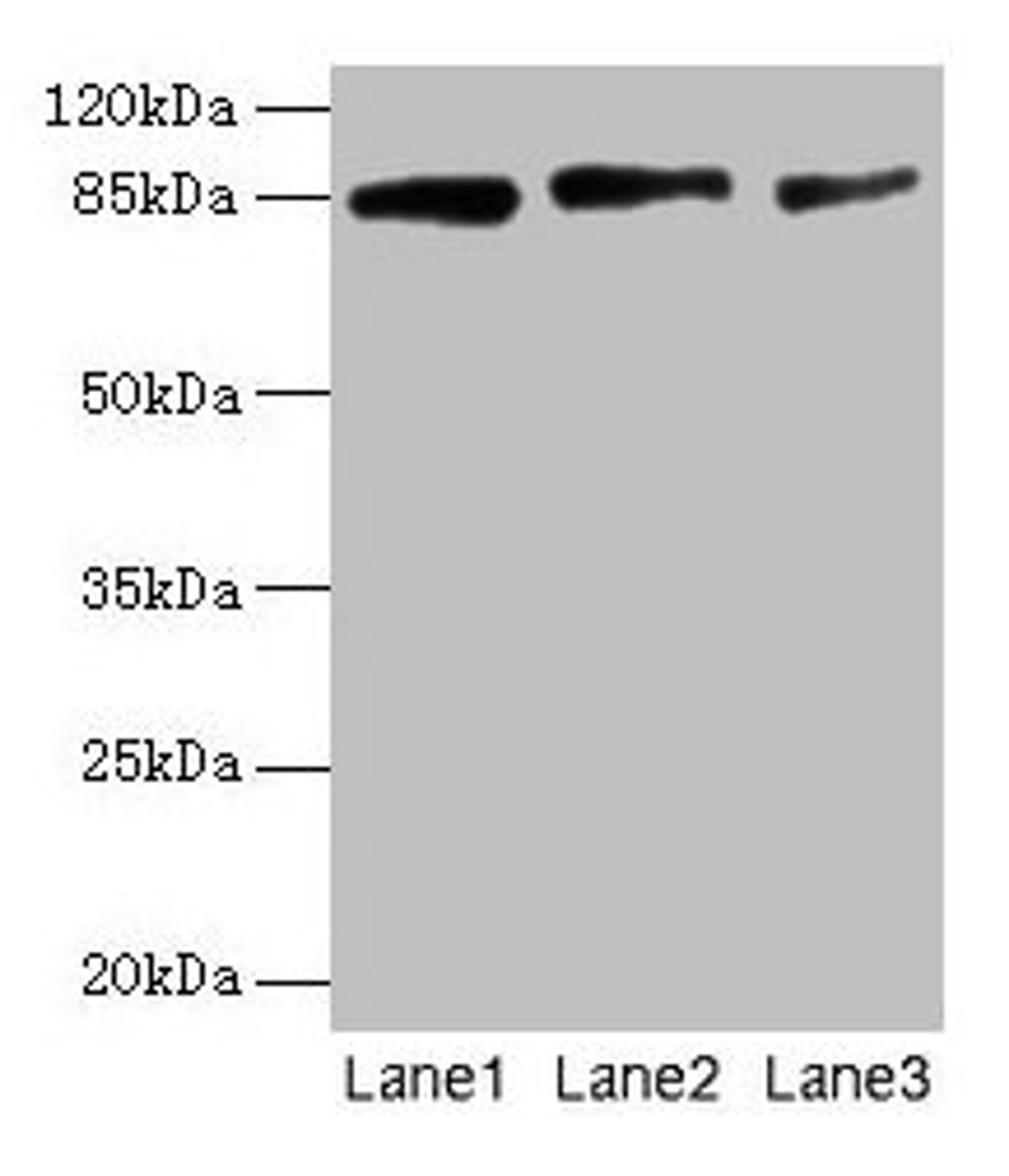 Western Blot. All lanes: PLOD2 antibody at 12µg/ml. Lane 1: U87 whole cell lysate. Lane 2: U251 whole cell lysate. Lane 3: 293T whole cell lysate. Secondary. Goat polyclonal to rabbit IgG at 1/10000 dilution. Predicted band size: 85, 88, 50 kDa. Observed band size: 85 kDa