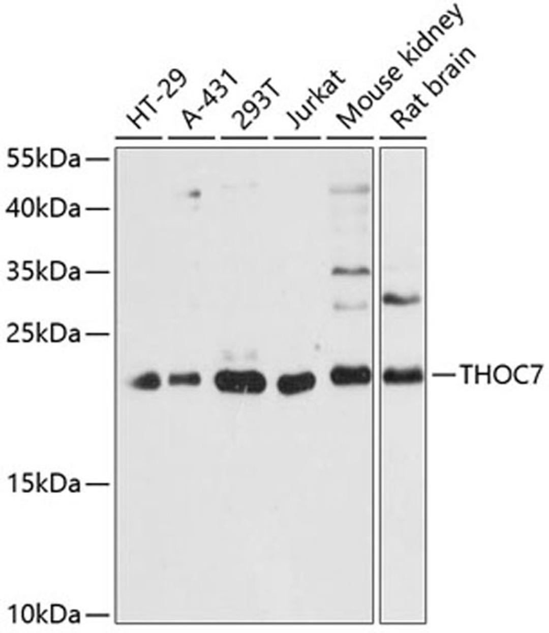 Western blot - THOC7 antibody (A13700)