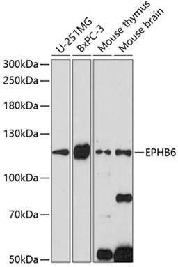 Western blot - EPHB6 antibody (A14728)