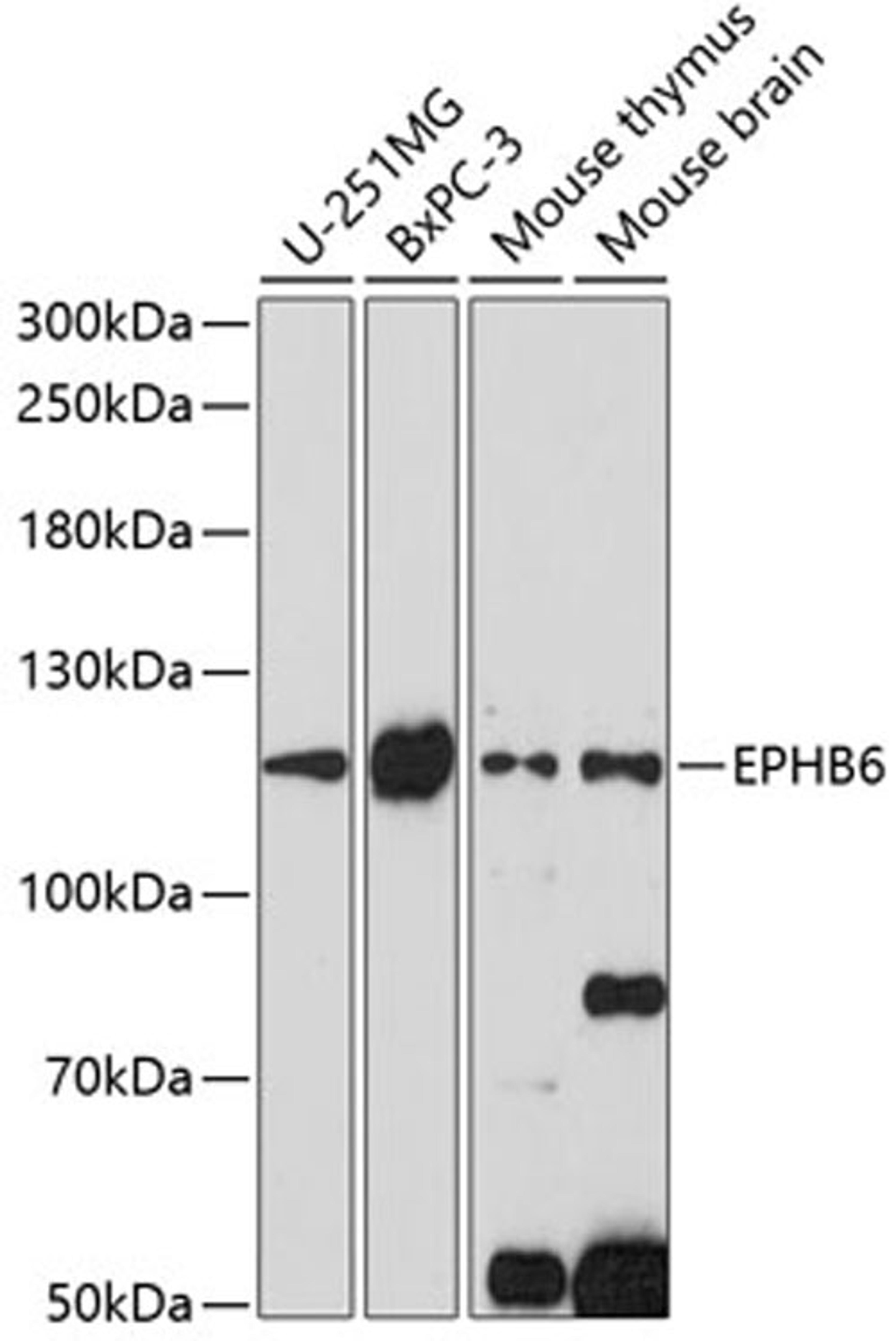 Western blot - EPHB6 antibody (A14728)