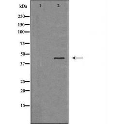 Western blot analysis of various cell lines using SERPINB3 antibody