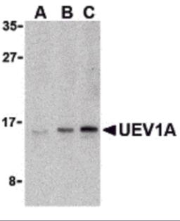 Western blot analysis of UEV1A in Jurkat cell lysates with UEV1A antibody at (A) 1, (B) 2, and (C) 4 &#956;g/mL.