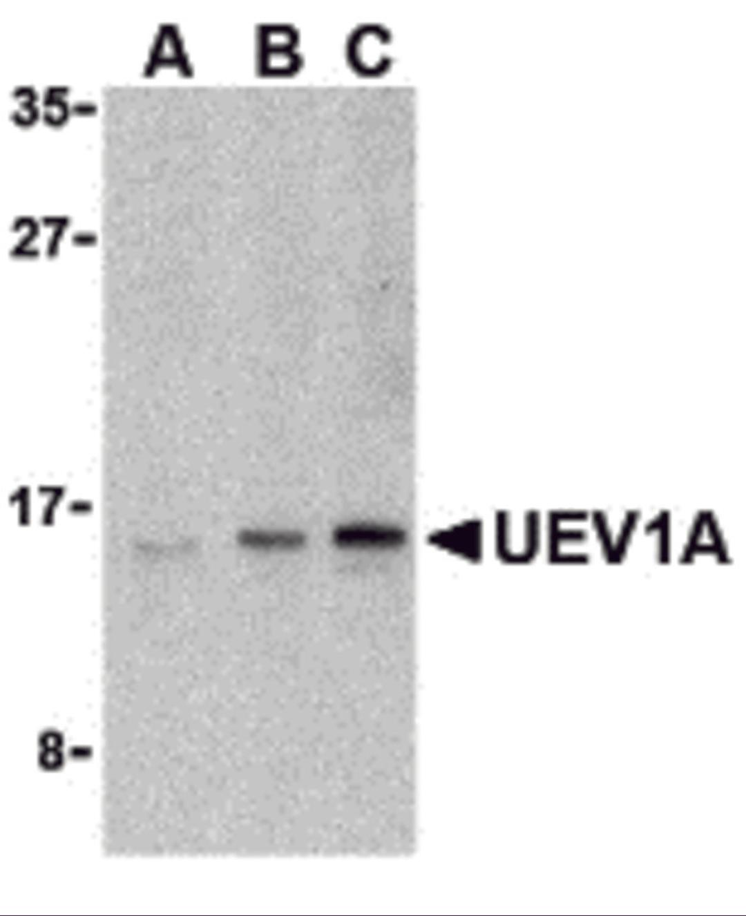 Western blot analysis of UEV1A in Jurkat cell lysates with UEV1A antibody at (A) 1, (B) 2, and (C) 4 μg/mL.