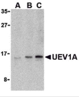 Western blot analysis of UEV1A in Jurkat cell lysates with UEV1A antibody at (A) 1, (B) 2, and (C) 4 μg/mL.