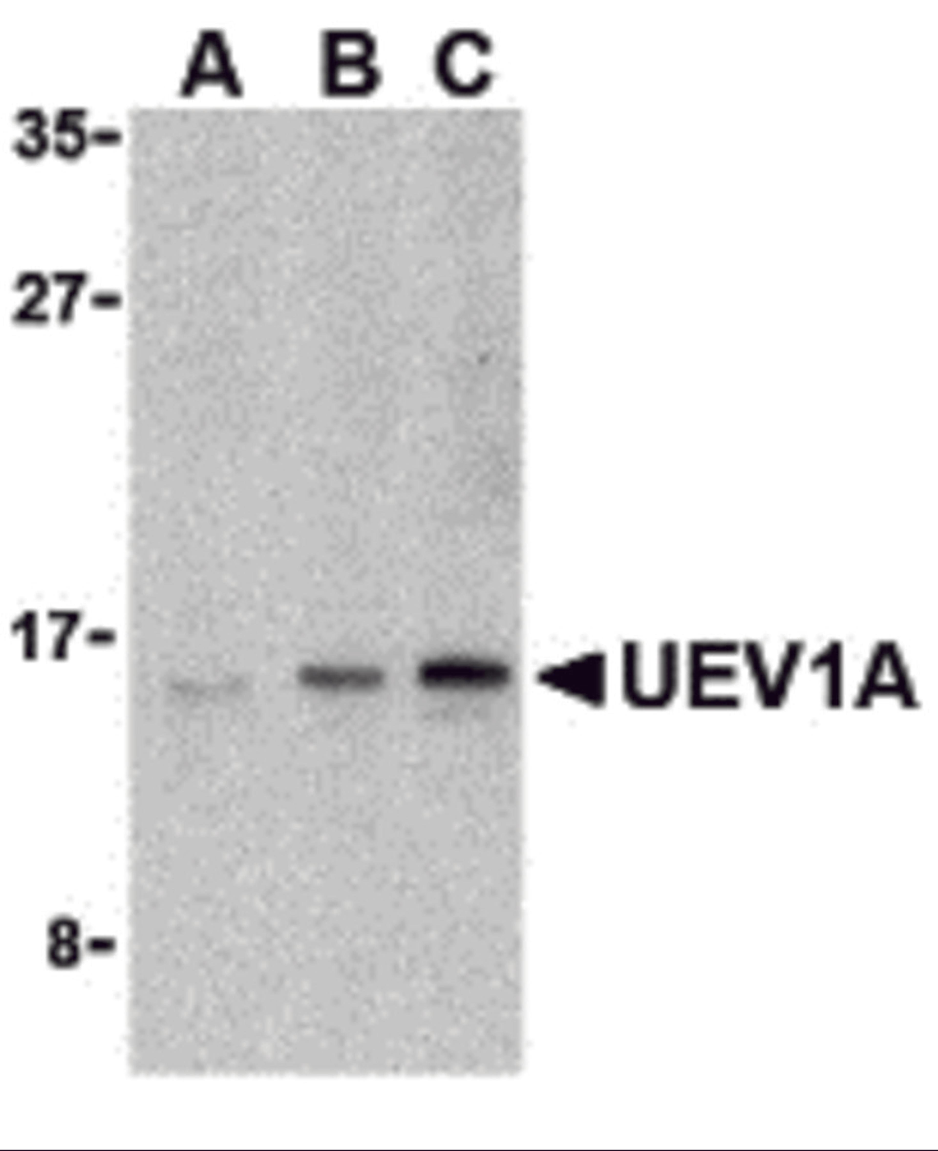 Western blot analysis of UEV1A in Jurkat cell lysates with UEV1A antibody at (A) 1, (B) 2, and (C) 4 μg/mL.