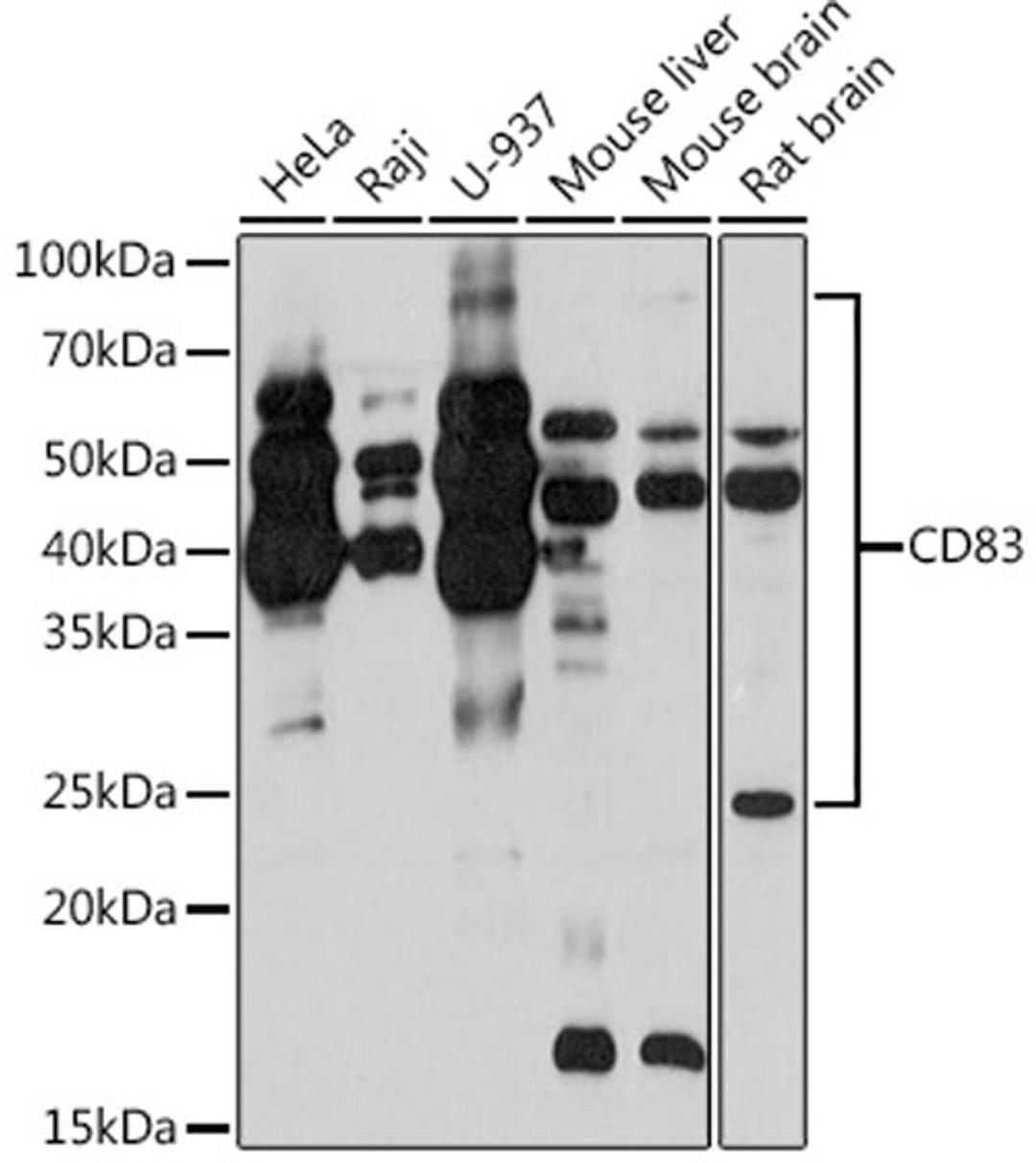 Western blot - CD83 Rabbit mAb (A4234)