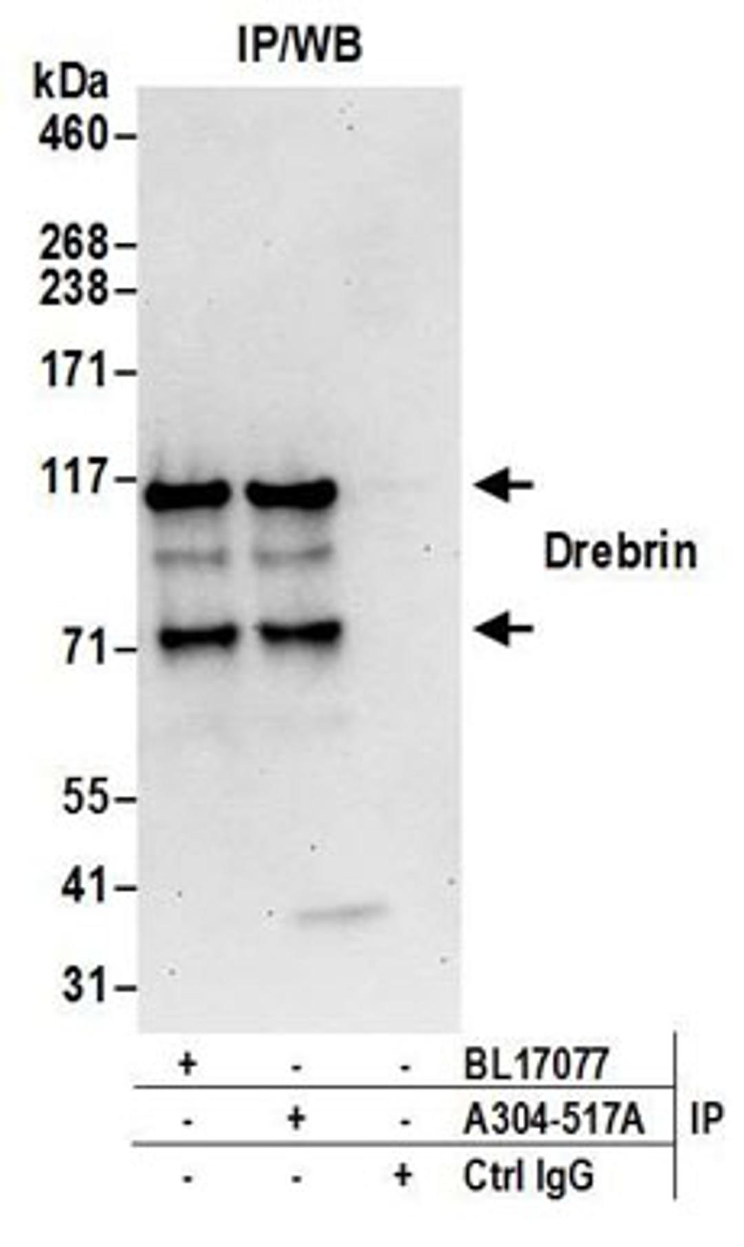 Detection of human Drebrin by western blot of immunoprecipitates.