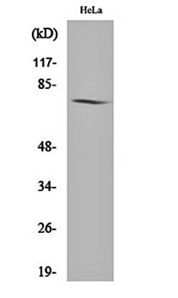 Western blot analysis of Hela cell lysates using Amphiphysin I antibody