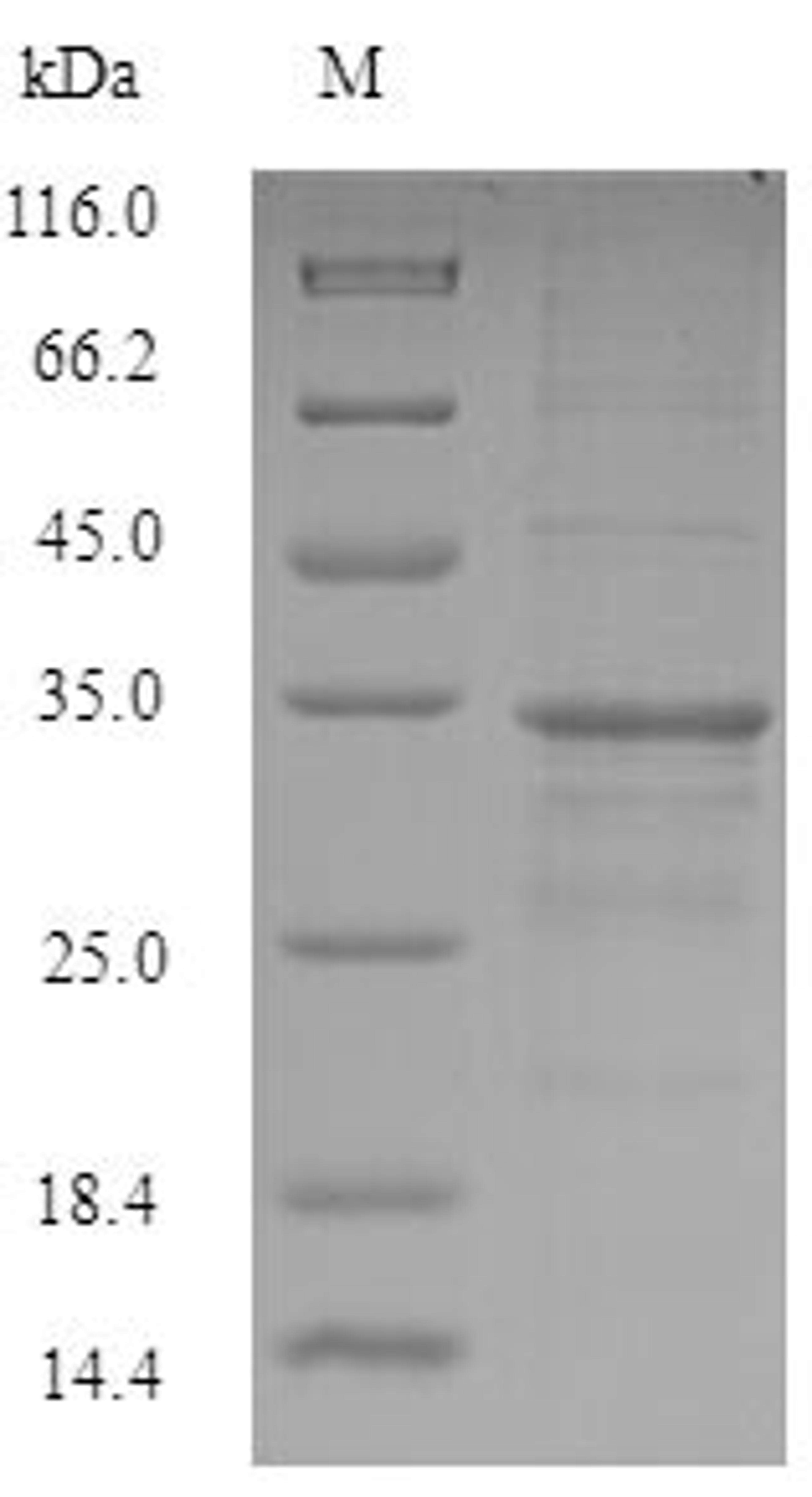 (Tris-Glycine gel) Discontinuous SDS-PAGE (reduced) with 5% enrichment gel and 15% separation gel.