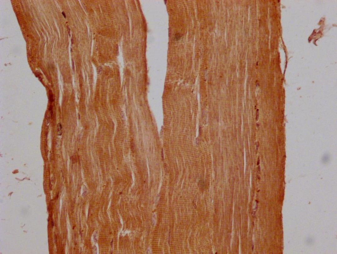 Immunohistochemistry of paraffin-embedded human skeletal muscle tissue using CSB-PA755482LA01HU at dilution of 1:300