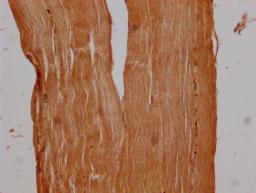 Immunohistochemistry of paraffin-embedded human skeletal muscle tissue using CSB-PA755482LA01HU at dilution of 1:300