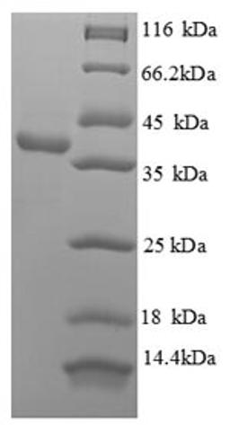 (Tris-Glycine gel) Discontinuous SDS-PAGE (reduced) with 5% enrichment gel and 15% separation gel.