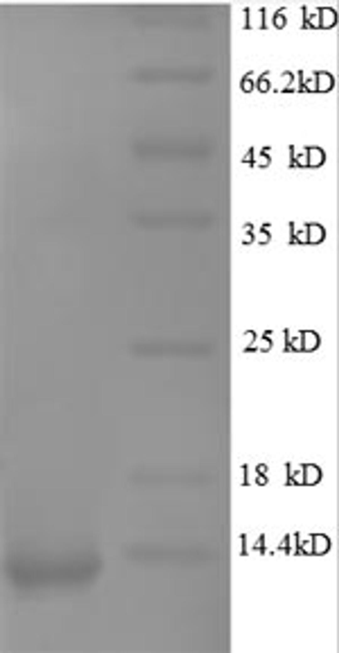 (Tris-Glycine gel) Discontinuous SDS-PAGE (reduced) with 5% enrichment gel and 15% separation gel.