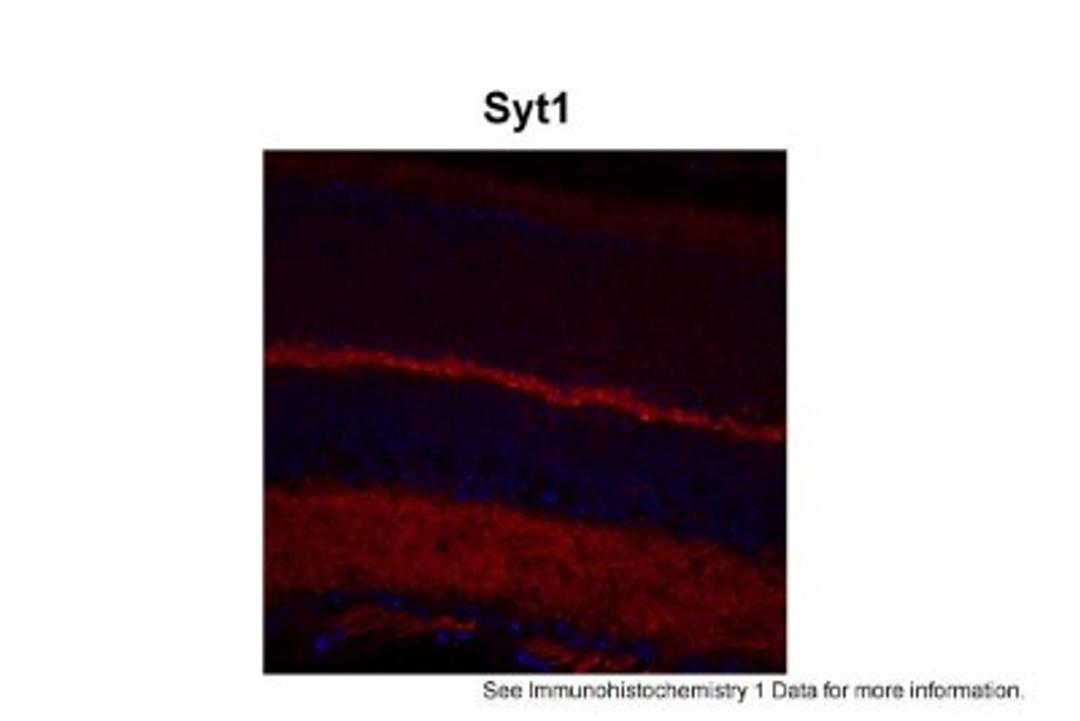 Immunocytochemistry/Immunofluorescence: Synaptotagmin 1 Antibody [NBP1-91499] - complete mouse retina sections Red: Primary Blue: DAPI Primary Dilution: 1:200 Secondary Antibody: Goat anti-Rabbit AF568 IgG(H+L) Secondary Dilution: 1:200 Image Submitted by: David Zenisek Yale University.