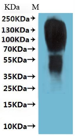 CSB-MP001466HU(A4) is detected by Mouse anti-6*His monoclonal antibody.