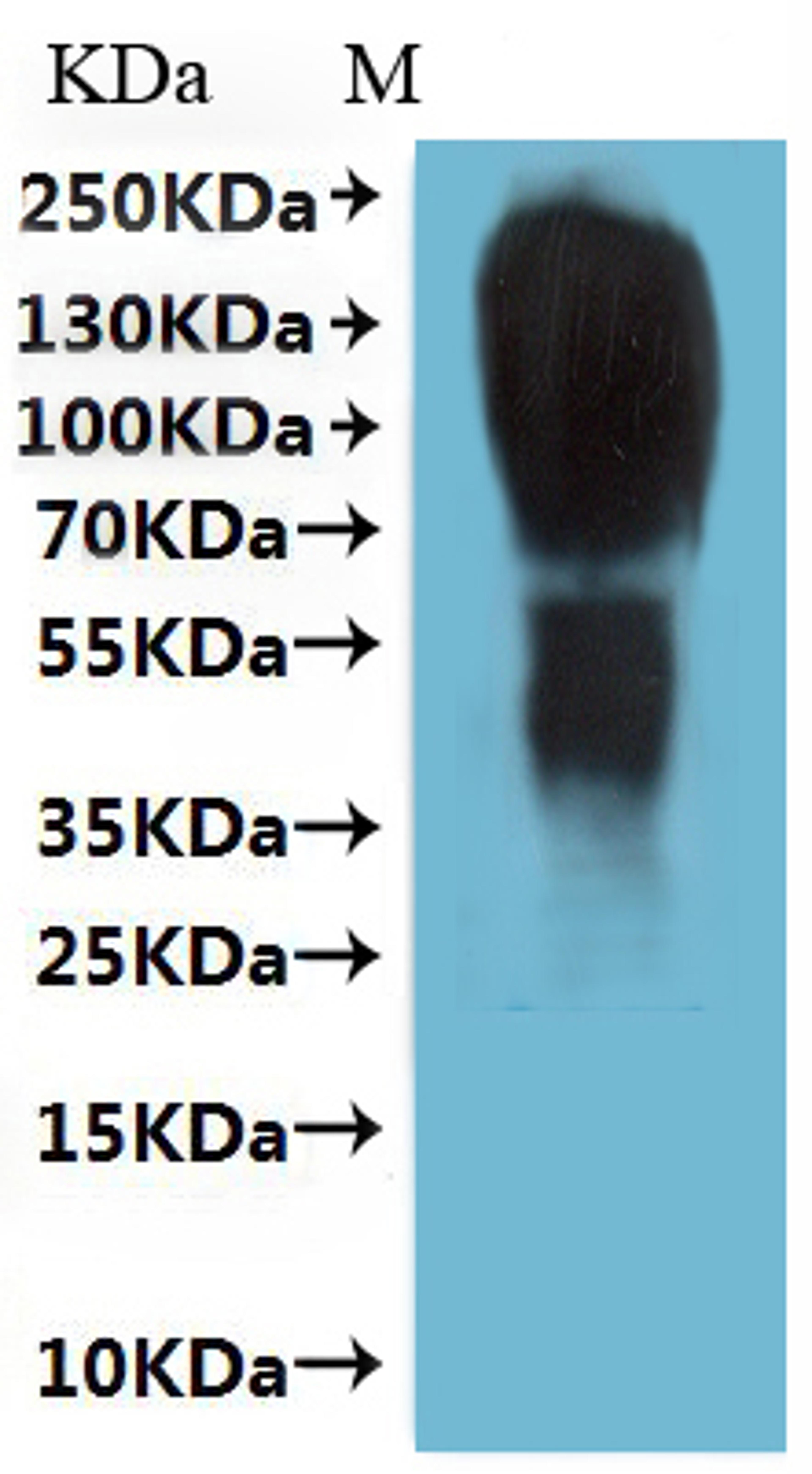 CSB-MP001466HU(A4) is detected by Mouse anti-6*His monoclonal antibody.