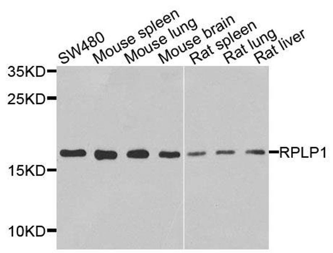 Western blot analysis of extracts of various cells using RPLP1 antibody