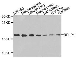 Western blot analysis of extracts of various cells using RPLP1 antibody