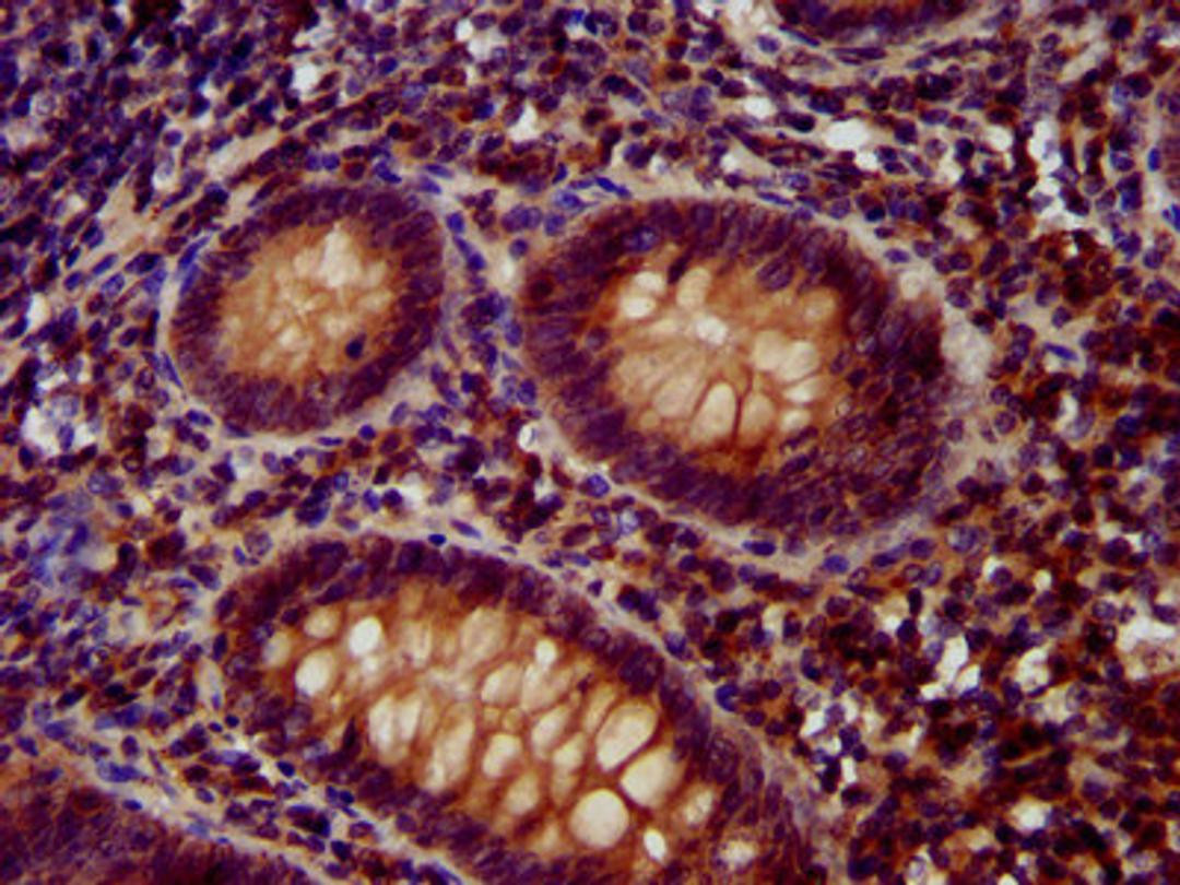 IHC image of CSB-PA753588LA01HU diluted at 1:400 and staining in paraffin-embedded human appendix tissue performed on a Leica BondTM system. After dewaxing and hydration, antigen retrieval was mediated by high pressure in a citrate buffer (pH 6.0). Section was blocked with 10% normal goat serum 30min at RT. Then primary antibody (1% BSA) was incubated at 4&deg;C overnight. The primary is detected by a biotinylated secondary antibody and visualized using an HRP conjugated SP system.