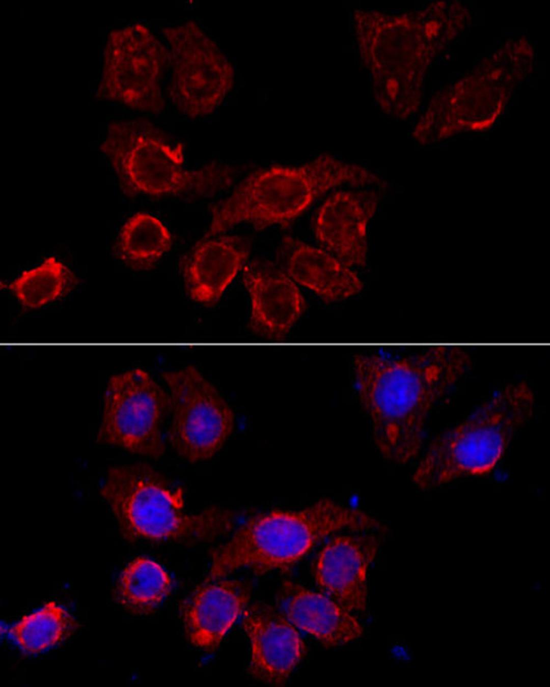 Immunofluorescence - CSF2RA antibody (A3167)