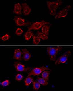 Immunofluorescence - CSF2RA antibody (A3167)