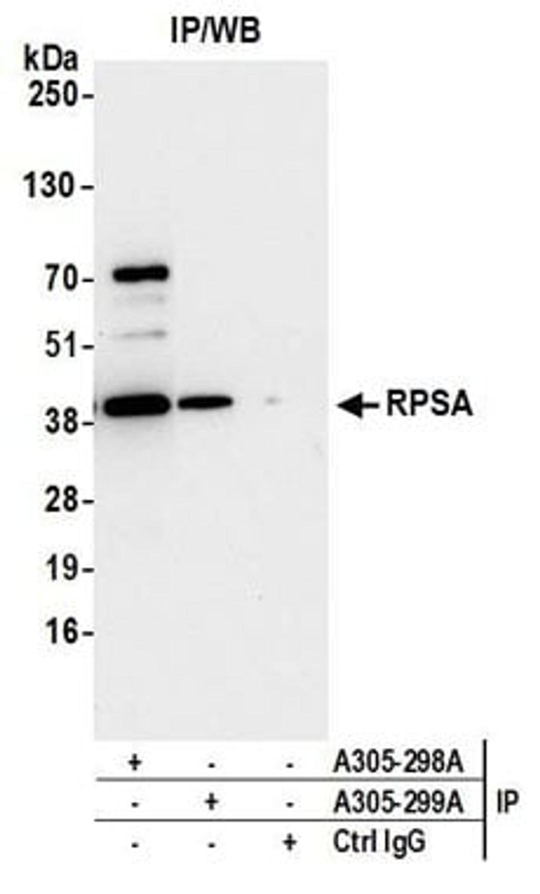 Detection of human RPSA by western blot of immunoprecipitates.