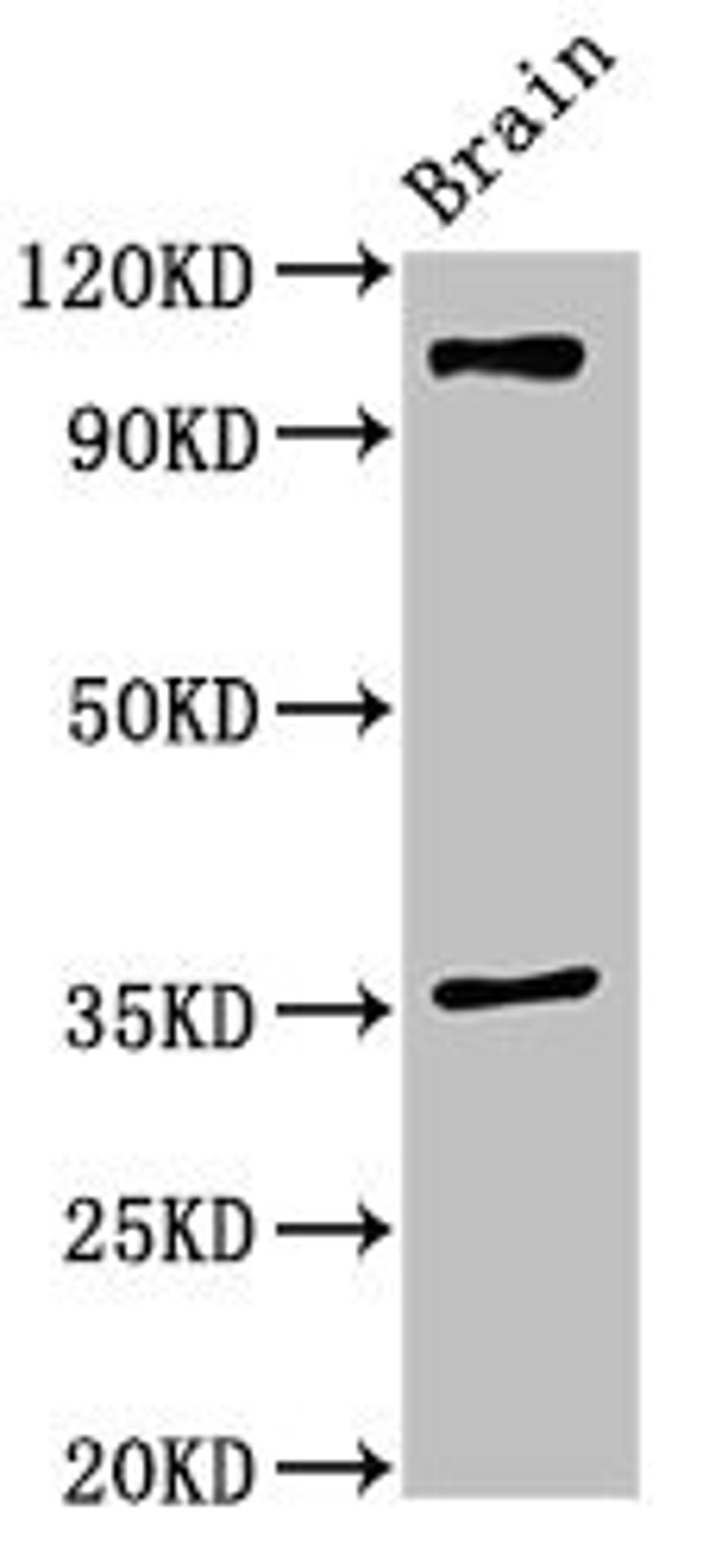 Western Blot. Positive WB detected in: Mouse brain tissue. All lanes: SLITRK5 antibody at 2ug/ml. Secondary. Goat polyclonal to rabbit IgG at 1/50000 dilution. Predicted band size: 108, 80 kDa. Observed band size: 108 kDa.