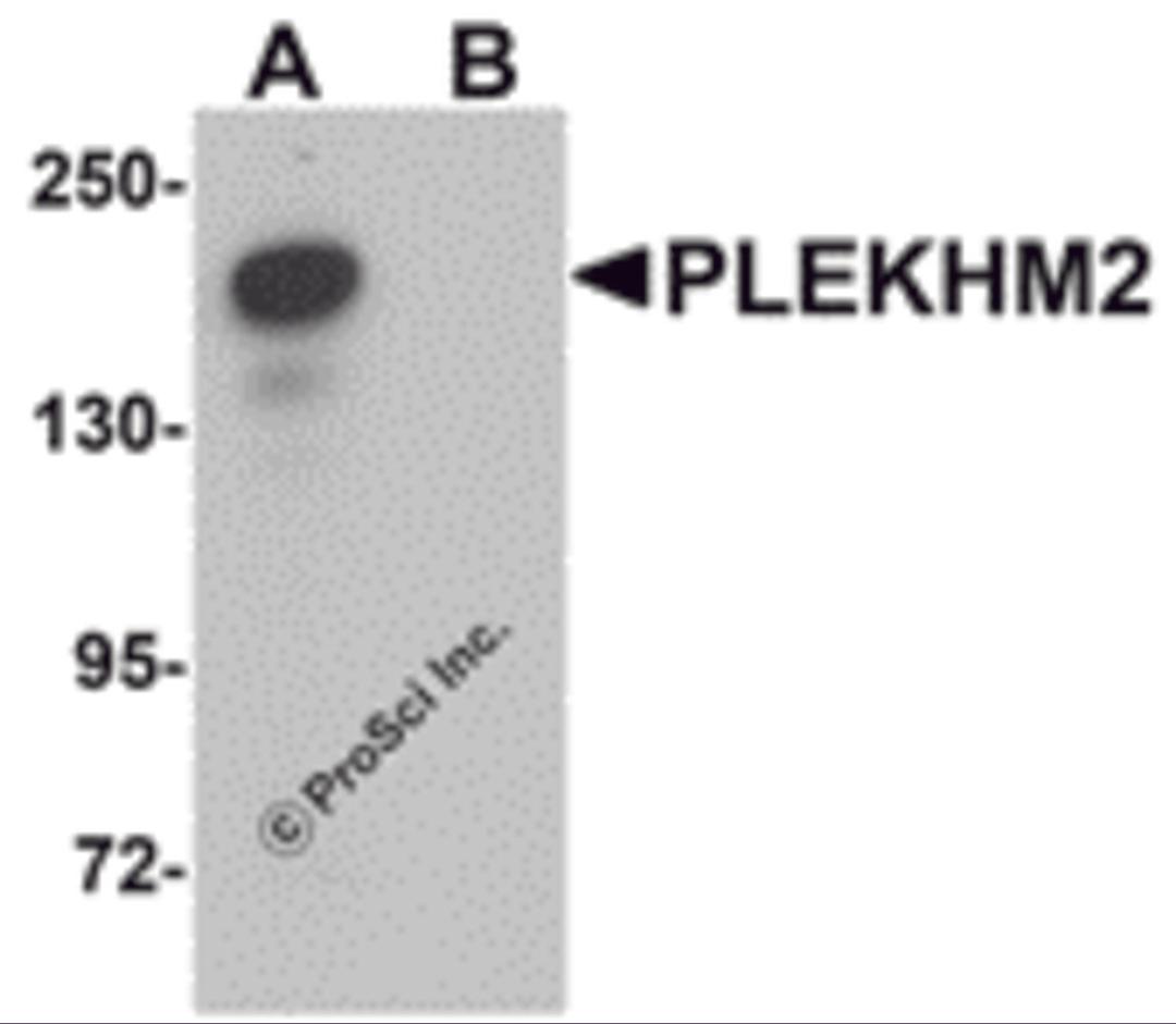 Western blot analysis of PLEKHM2 in rat brain tissue lysate with PLEKHM2 antibody at 0.5 μg/mL in (A) the absence and (B) the presence of blocking peptide.