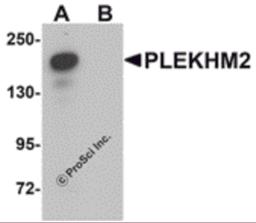 Western blot analysis of PLEKHM2 in rat brain tissue lysate with PLEKHM2 antibody at 0.5 μg/mL in (A) the absence and (B) the presence of blocking peptide.