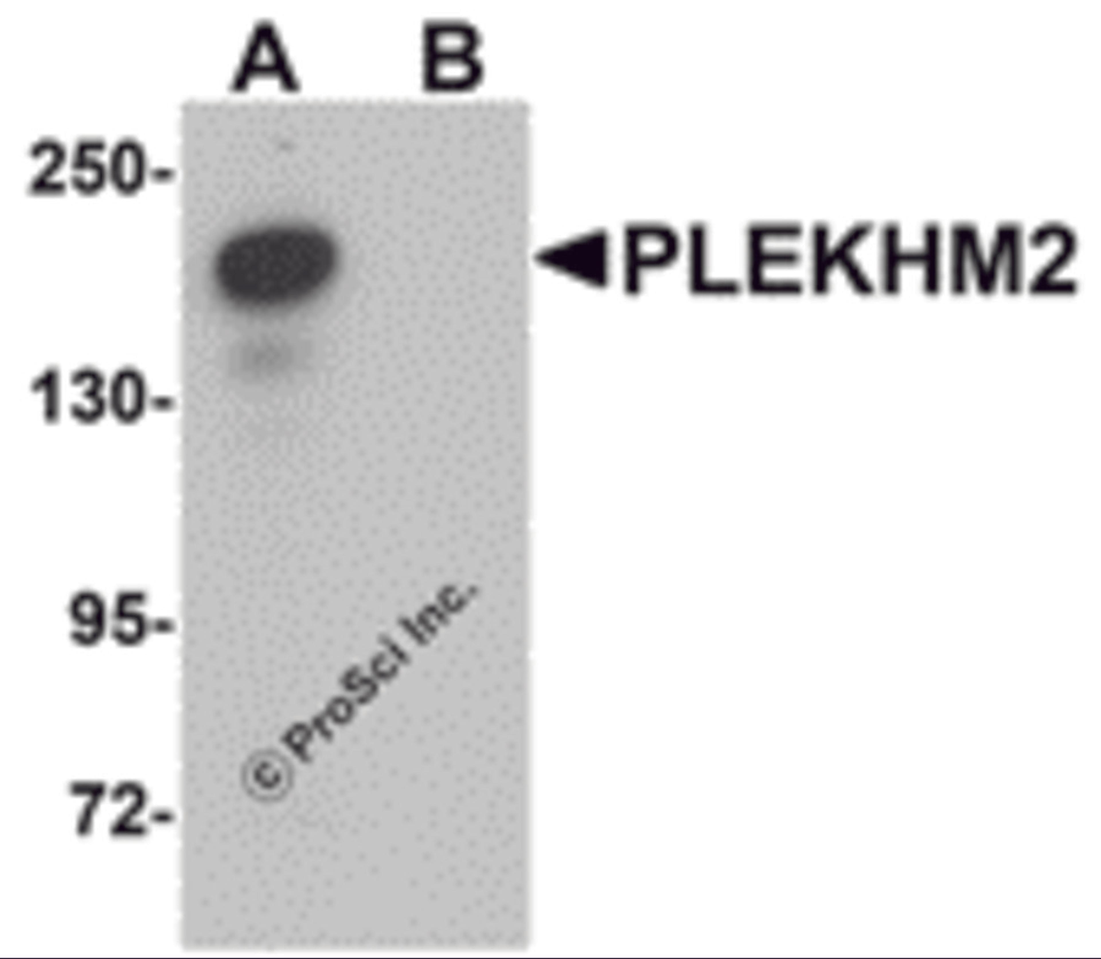 Western blot analysis of PLEKHM2 in rat brain tissue lysate with PLEKHM2 antibody at 0.5 μg/mL in (A) the absence and (B) the presence of blocking peptide.